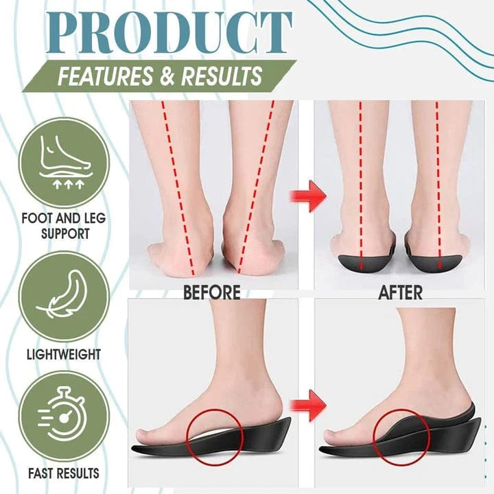 Flat Foot Orthopedic Insoles Shoe Feet With Arches Foot Soles For Flat Feet - Flat Foot Orthopedic Insoles