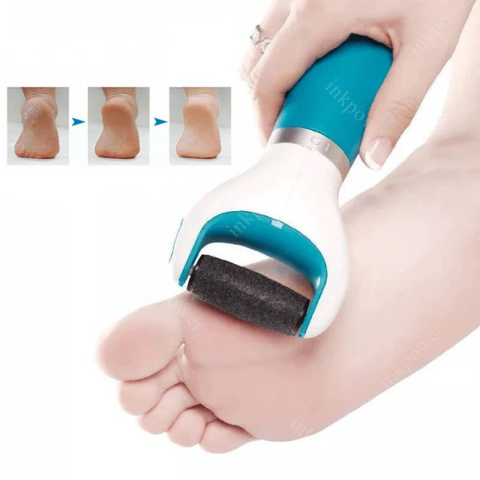 Foot Roller Callus Remover | Callus Remover Foot Scrubber Dead Skin Remover For Feet - Foot Roller Callus Remover