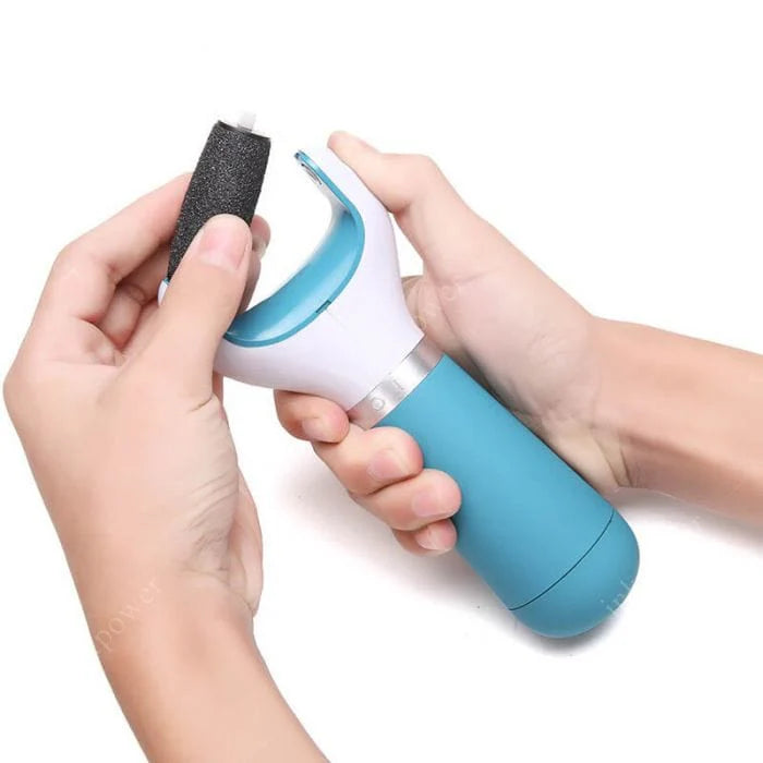 Foot Roller Callus Remover | Callus Remover Foot Scrubber Dead Skin Remover For Feet - Foot Roller Callus Remover